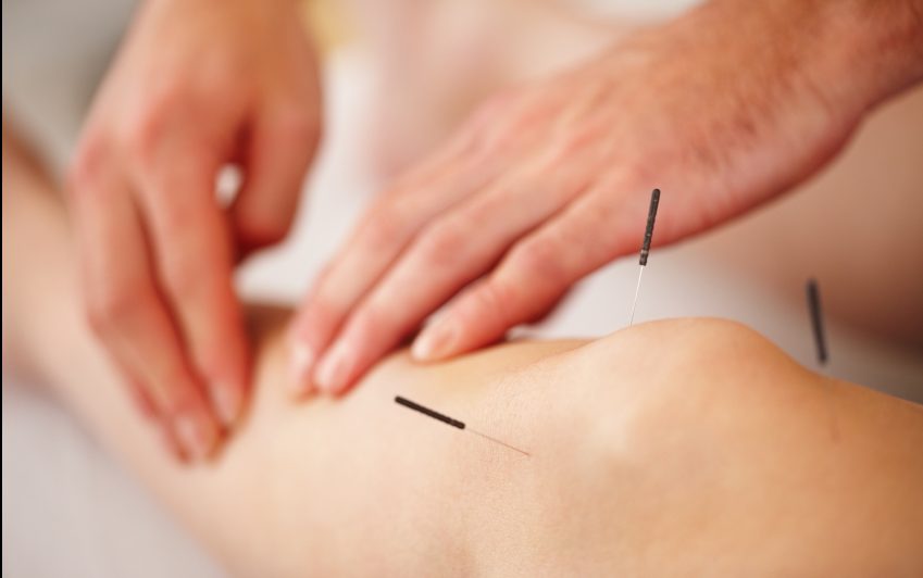 Hva er akupunktur